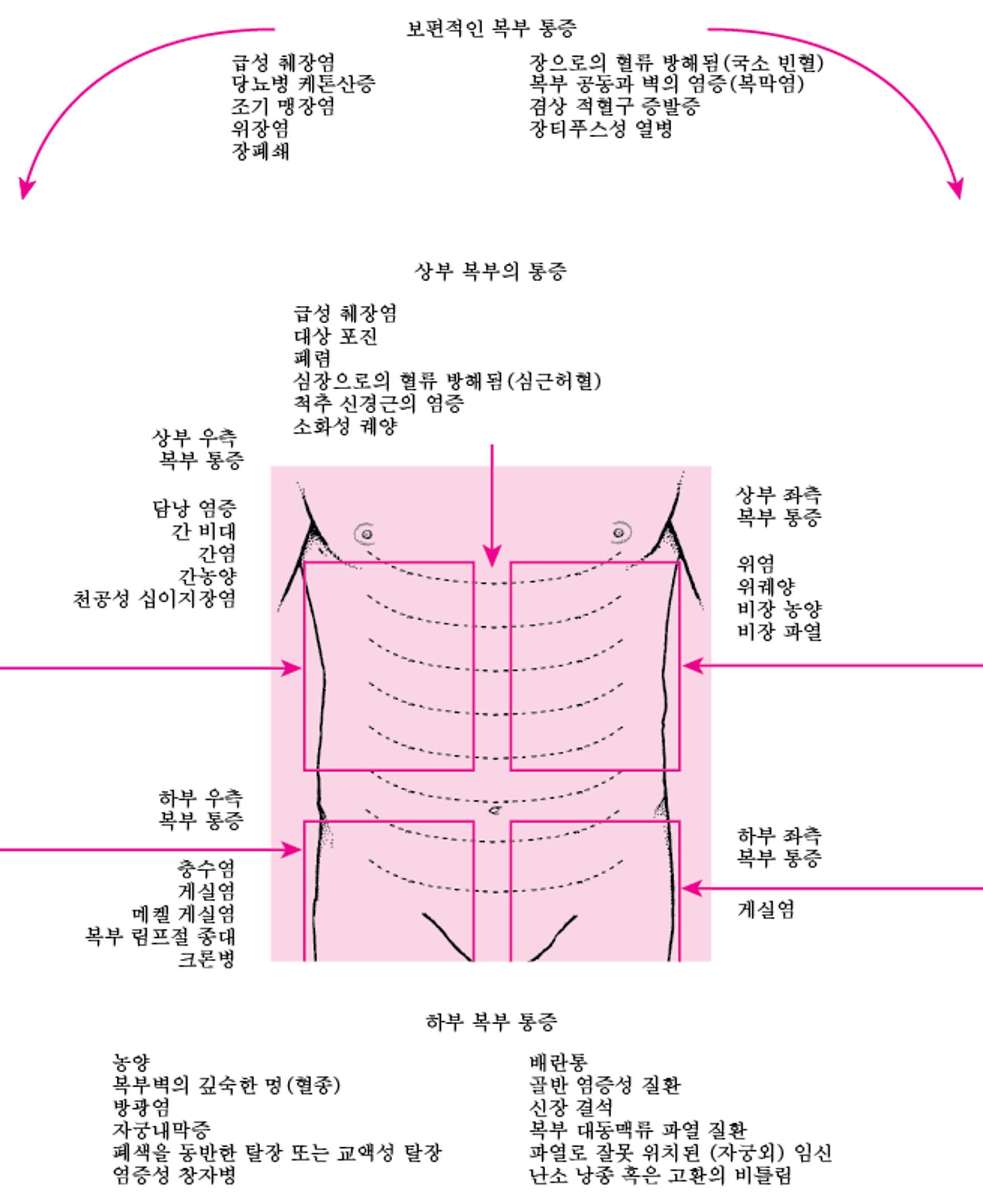 위치별 복통 원인