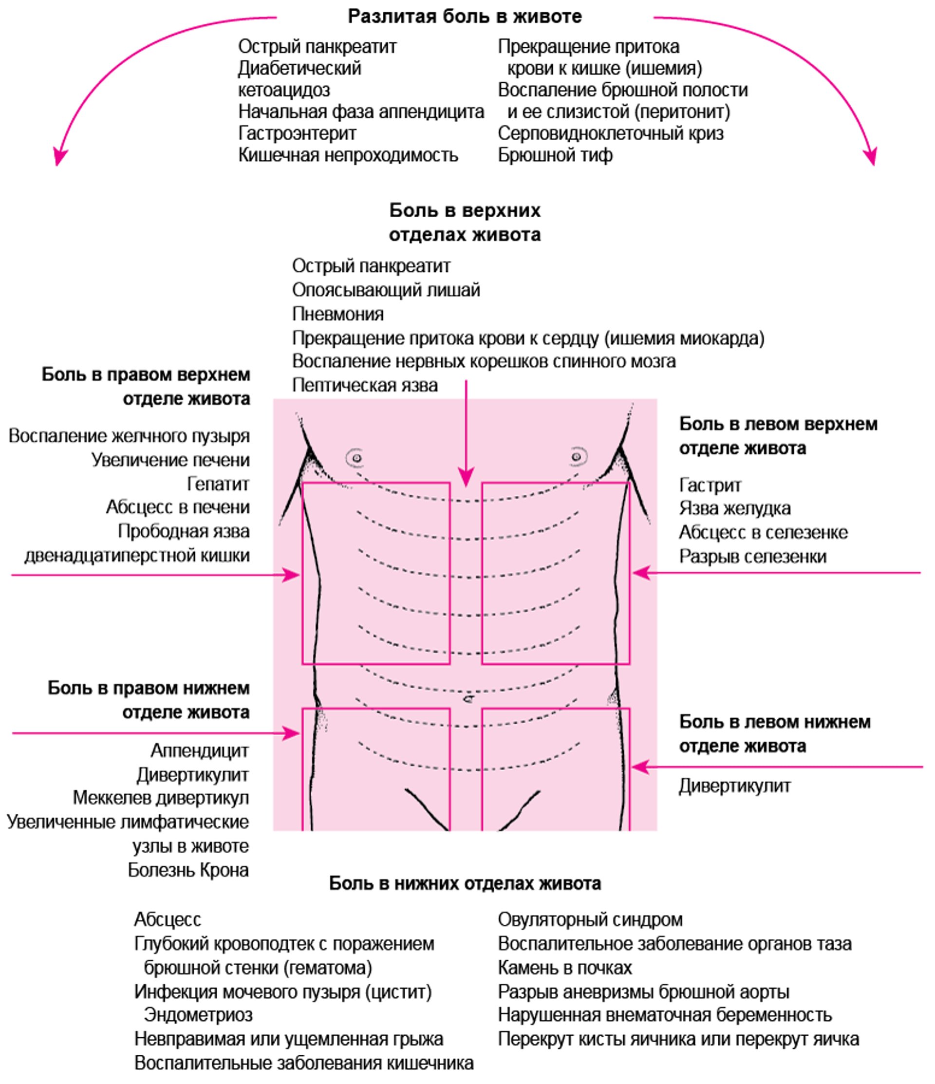 Причины боли в животе, в зависимости от местоположения