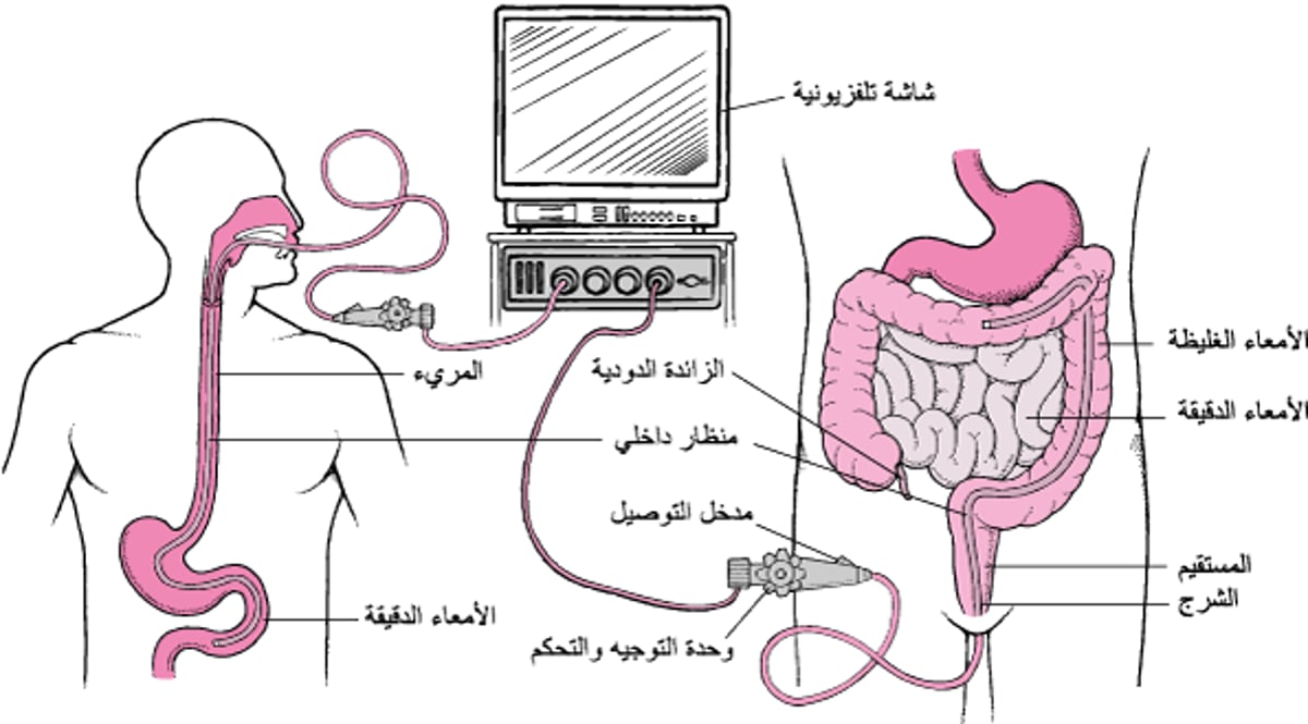 مُعايَنة السبيل الهضميّ بالمنظار