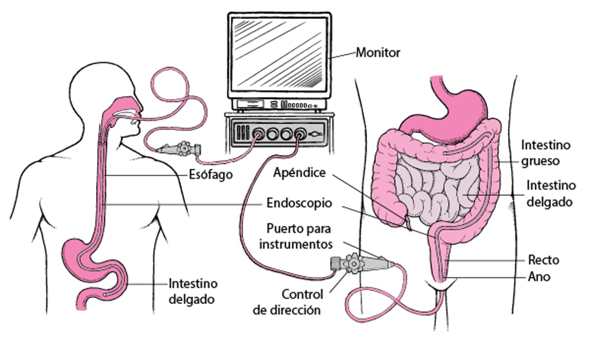 Visualización del tubo digestivo con un endoscopio