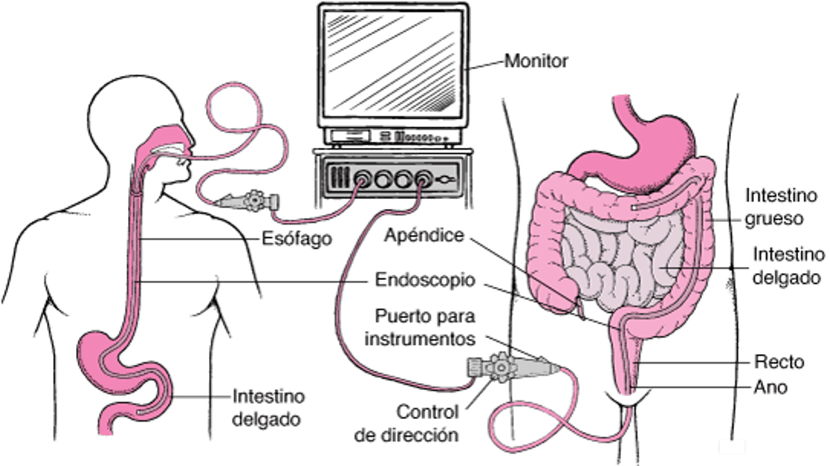 Visualización del tubo digestivo con un endoscopio