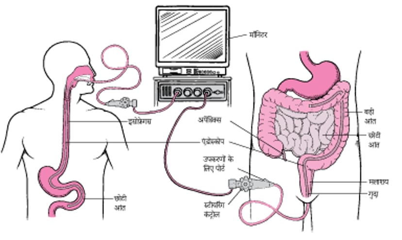 एंडोस्कोप के साथ पाचन क्षेत्र देखना