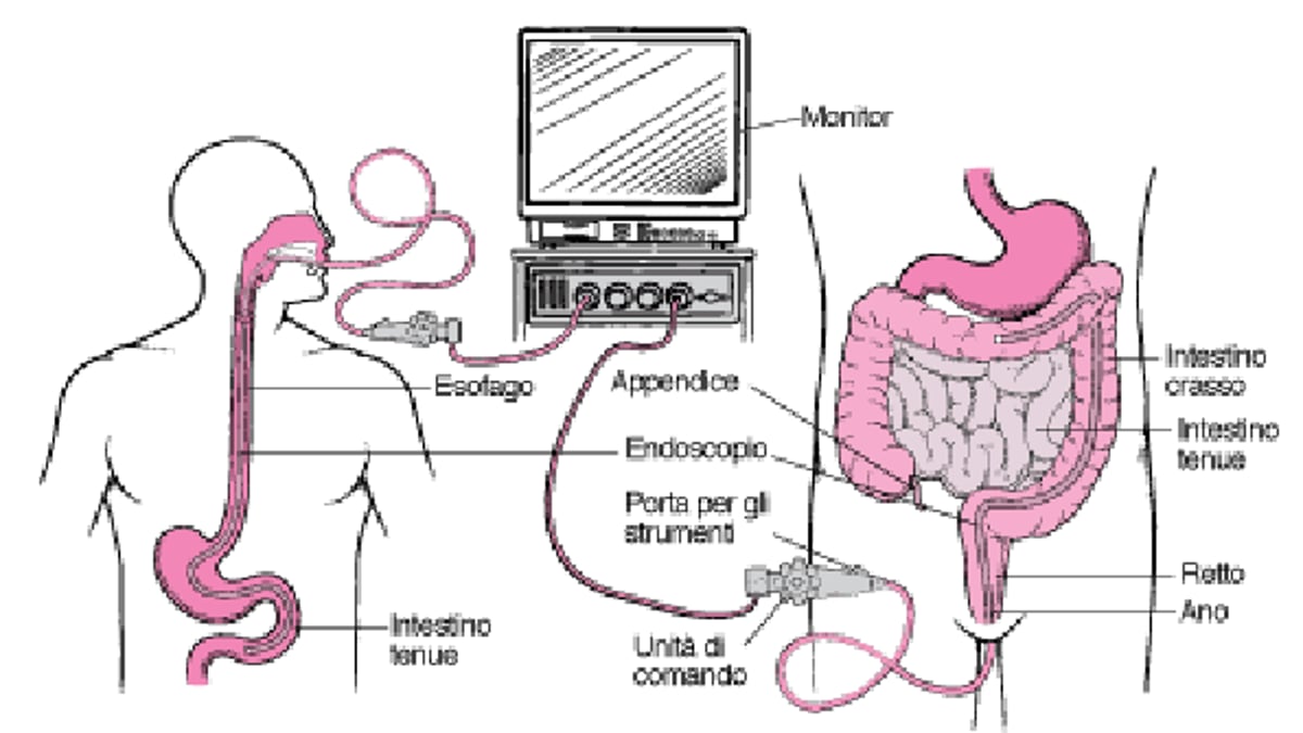 Esplorazione del tratto digerente con endoscopio