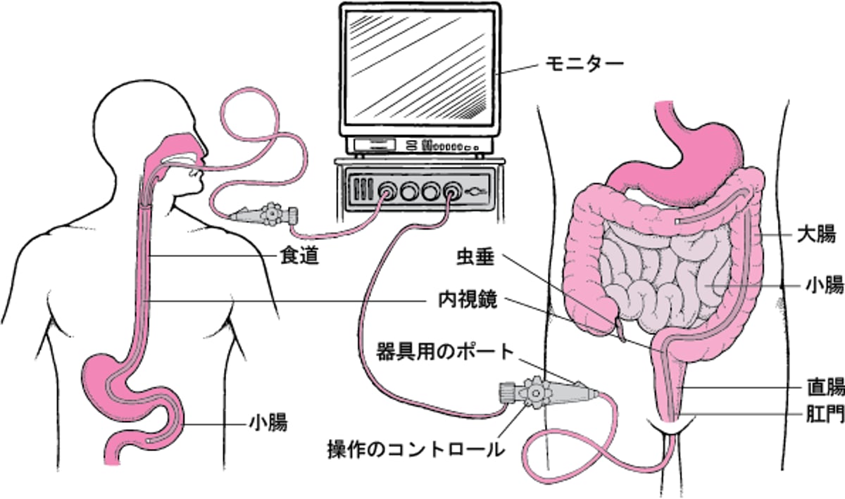 <ruby >内視鏡<rt >ないしきょう</rt></ruby>による<ruby >消化管<rt >しょうかかん</rt></ruby>の<ruby >観察<rt >かんさつ</rt></ruby>