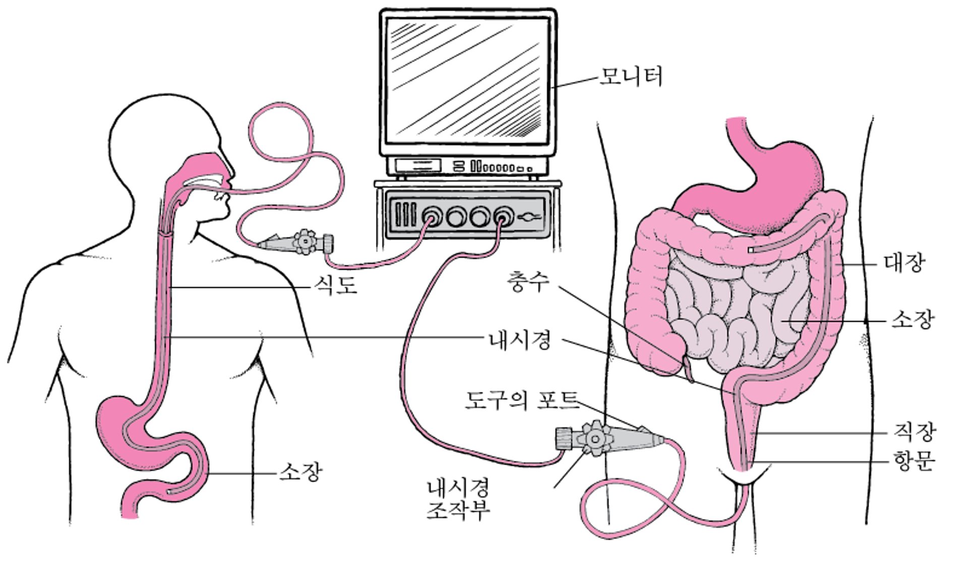 내시경을 통한 소화관 관찰