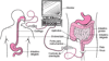 Visualização do trato digestivo com um endoscópio