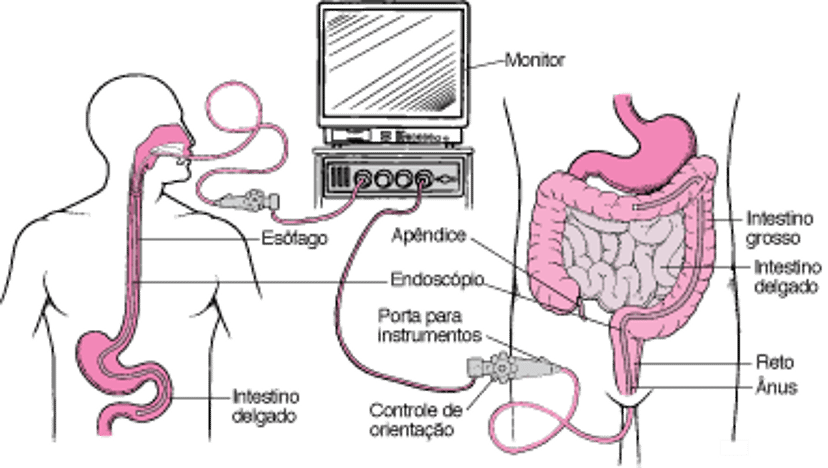 Visualização do trato digestivo com um endoscópio