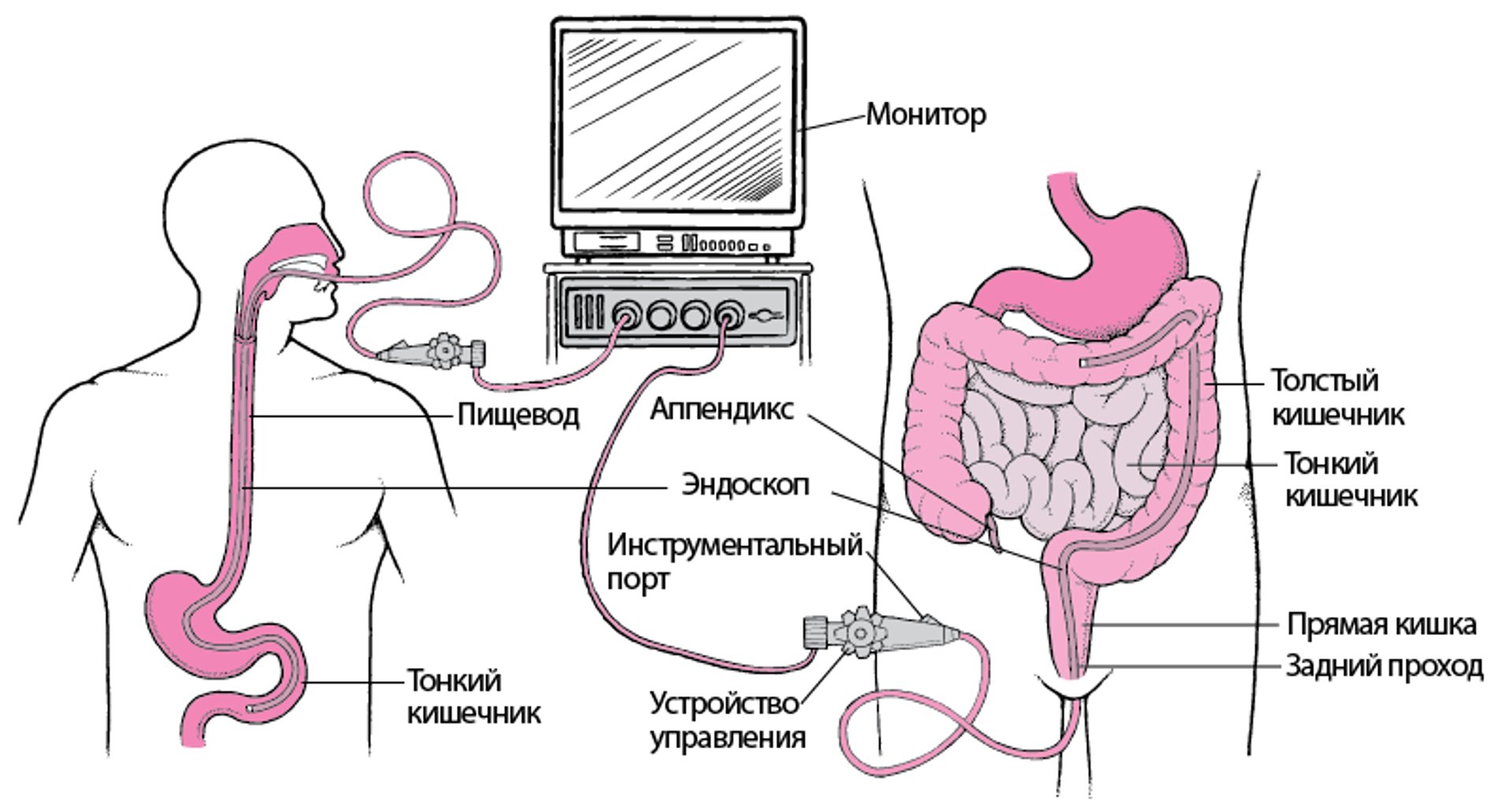 Обследование пищеварительного тракта с помощью эндоскопа