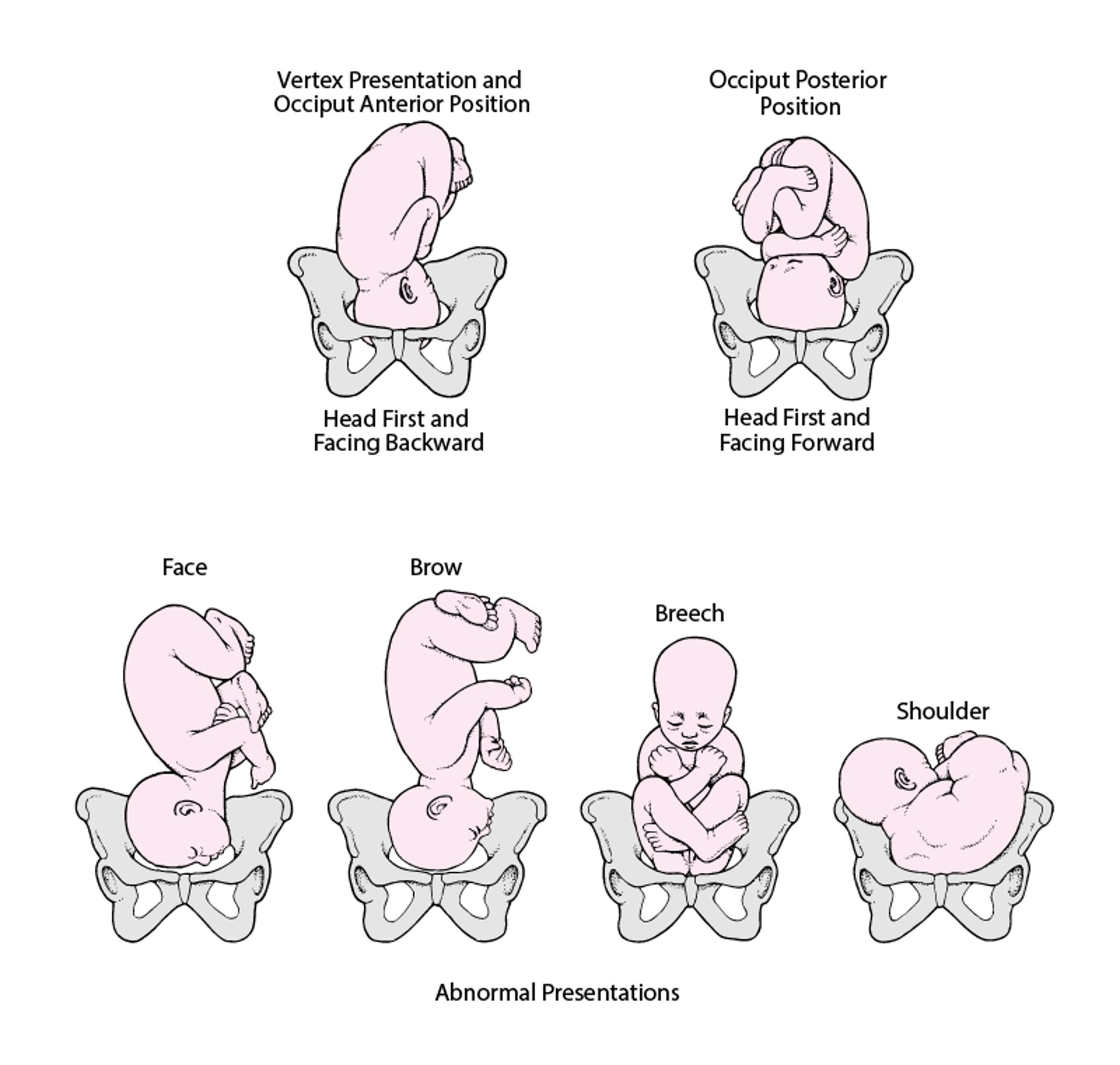 Posición y presentación del feto