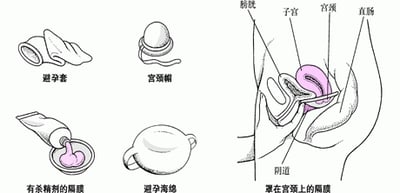 防止到达：工具避孕