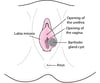What Is Bartholin Gland Cyst?