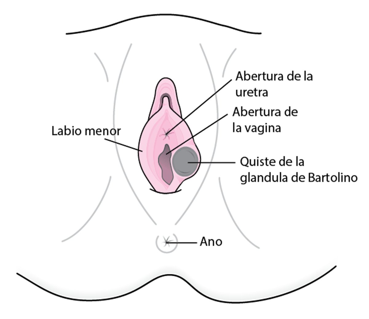 ¿Qué es un quiste en la glándula de Bartolino?