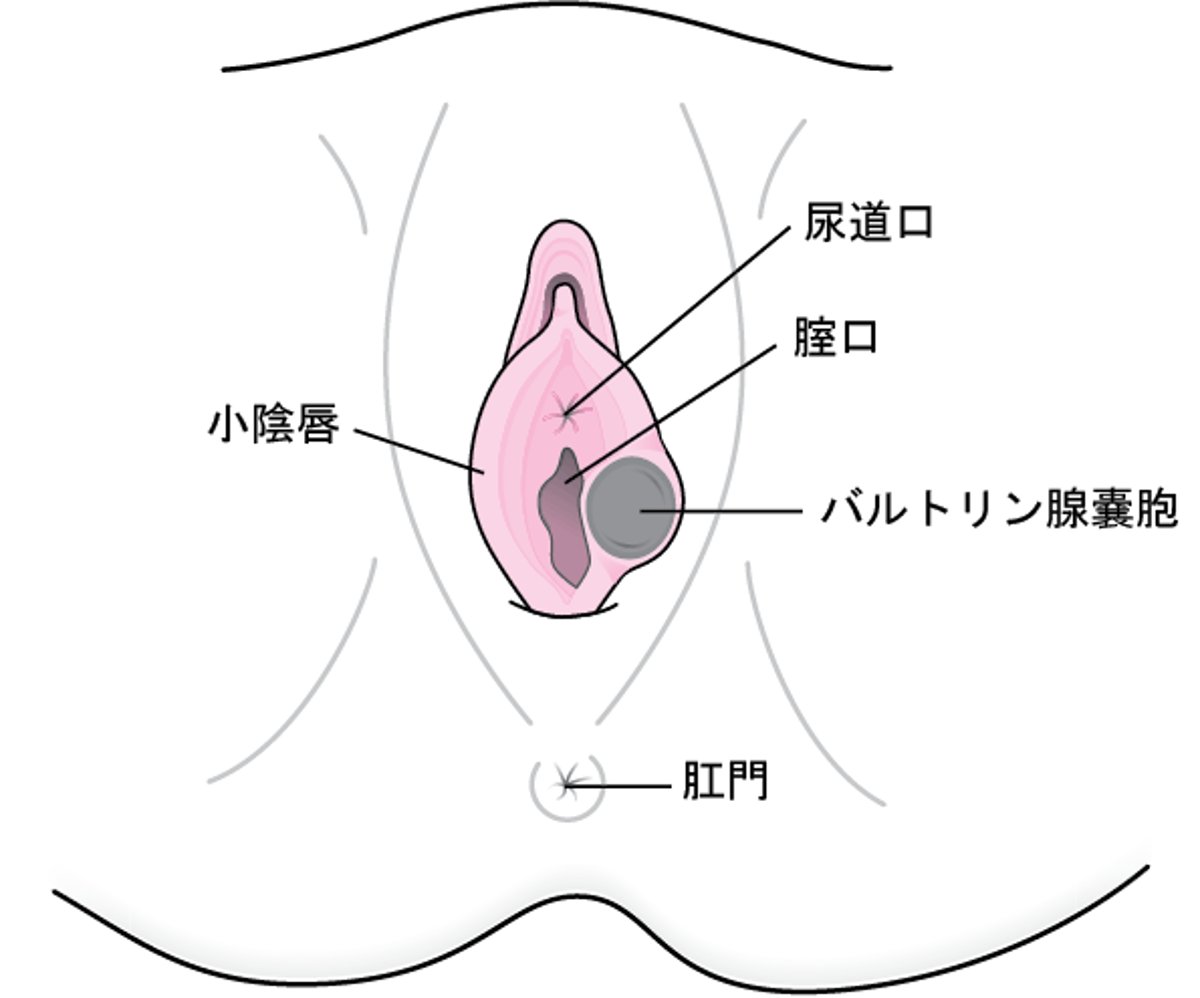 バルトリン腺嚢胞とは