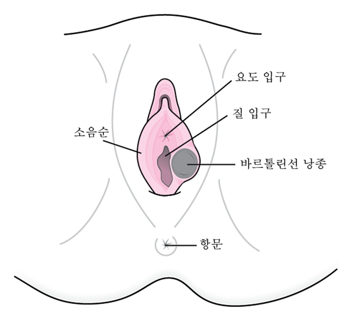 바르톨린선 낭종이란 무엇인가?