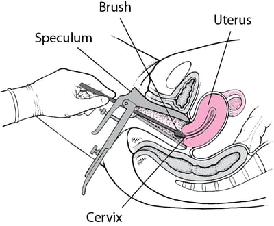 Pap Test