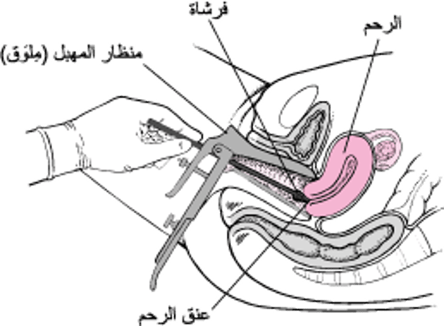 اختبار لطاخة بابانيكولاو