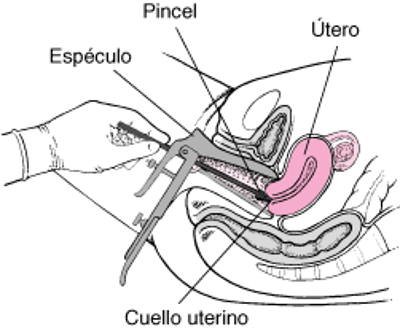 Prueba de Papanicoláu