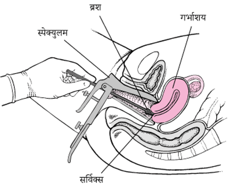 Pap परीक्षण