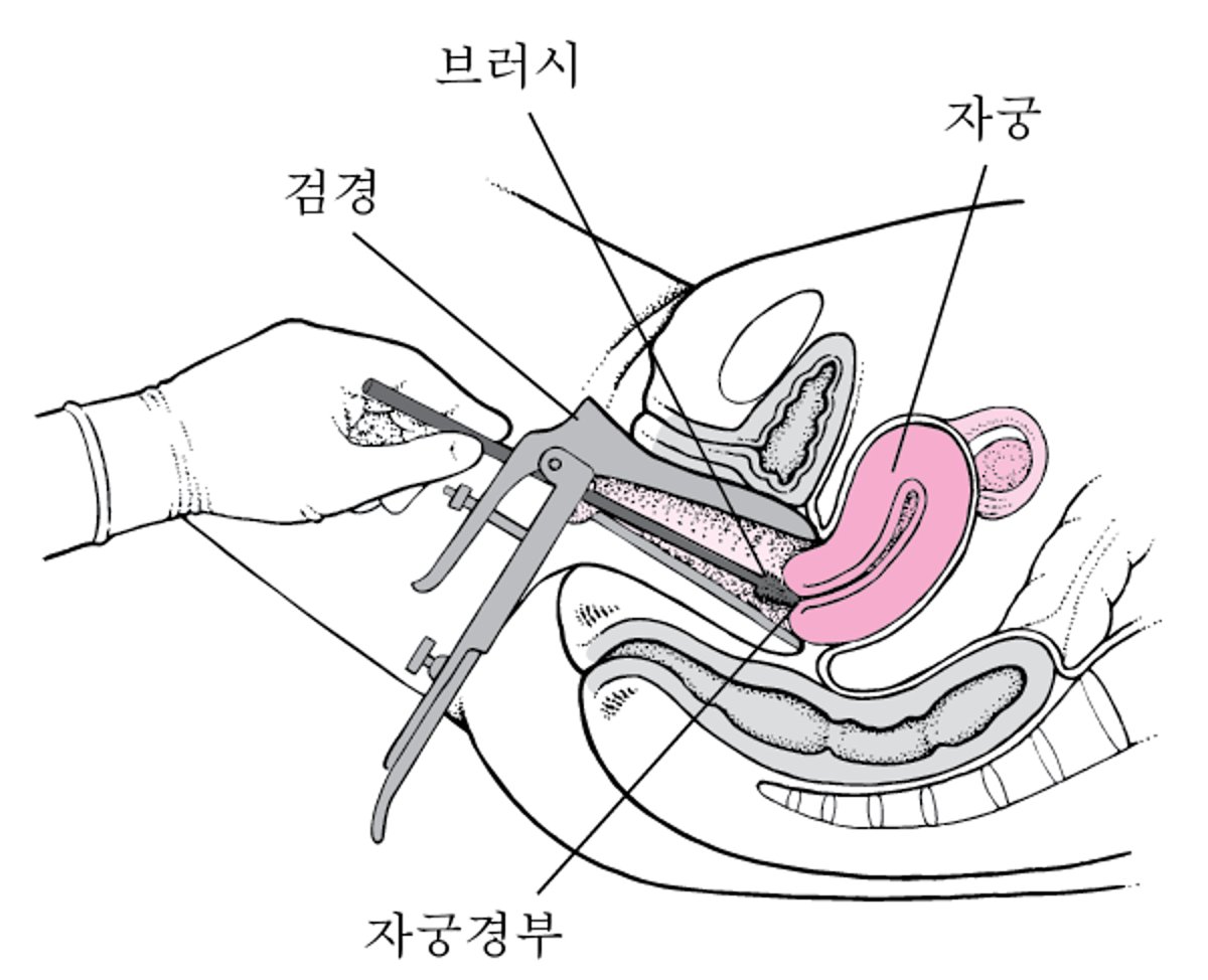 자궁경부 세포 채취