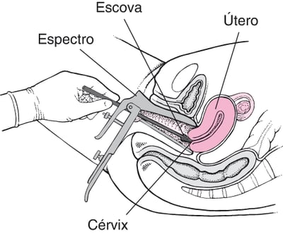 Coleta de células cervicais