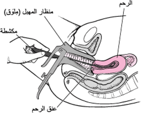 التَّوسيعُ والتَّجريف