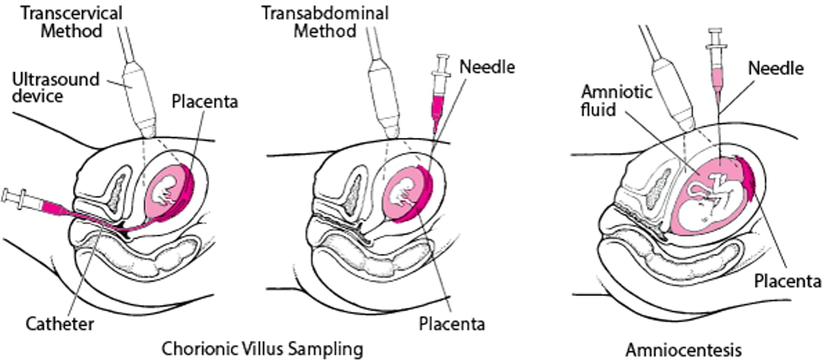 Detecting Abnormalities Before Birth