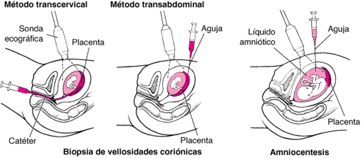 Detección de anomalías antes del nacimiento