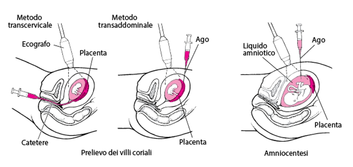 Riconoscimento di anomalie in epoca prenatale
