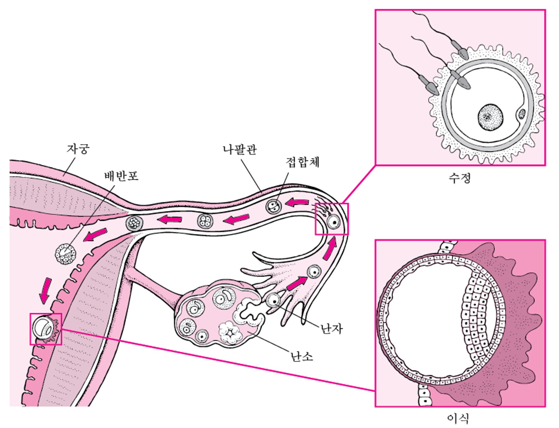 수정에서 착상으로