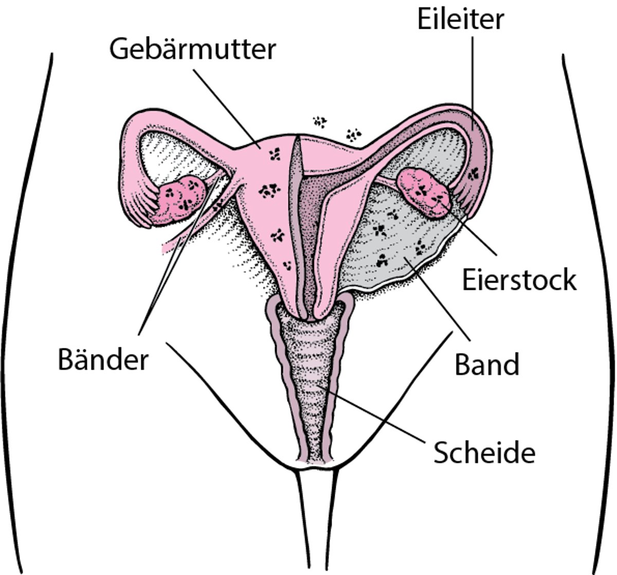 Endometriose: Versprengtes Gewebe
