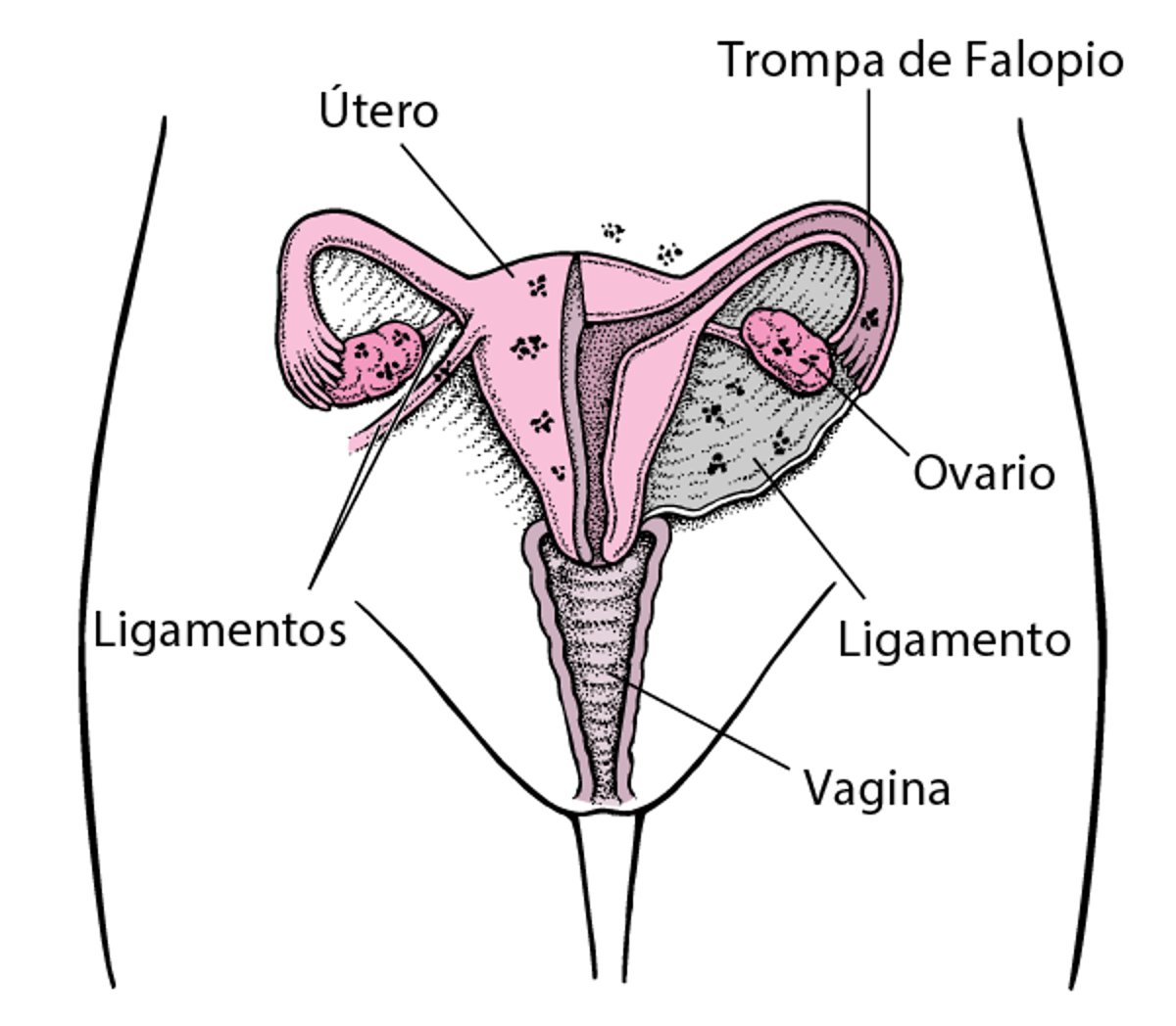Endometriosis: tejido ectópico (fuera de su lugar habitual)