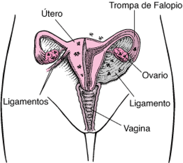 Endometriosis: tejido ectópico (fuera de su lugar habitual)