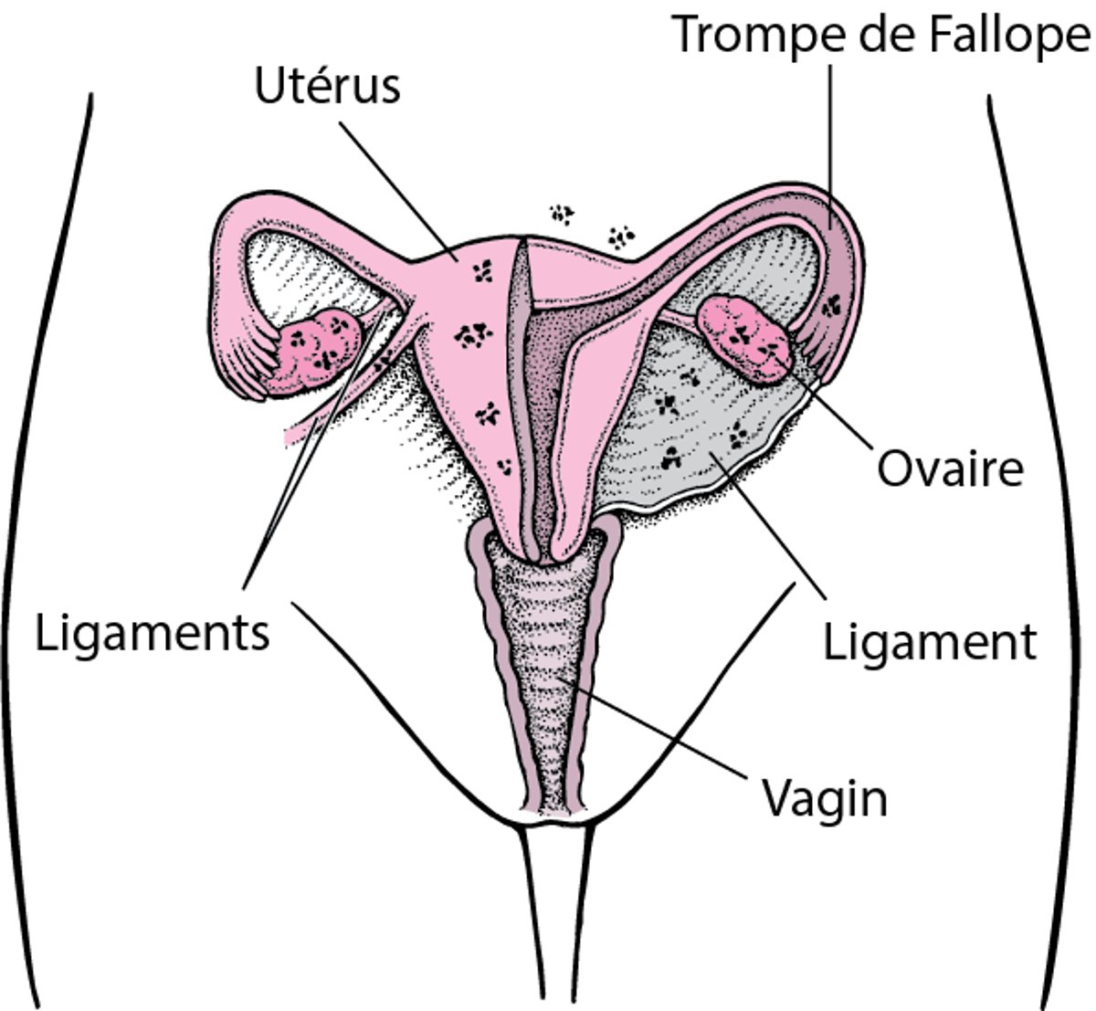 Endométriose : tissu mal placé