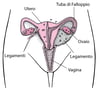Endometriosi: tessuto dislocato