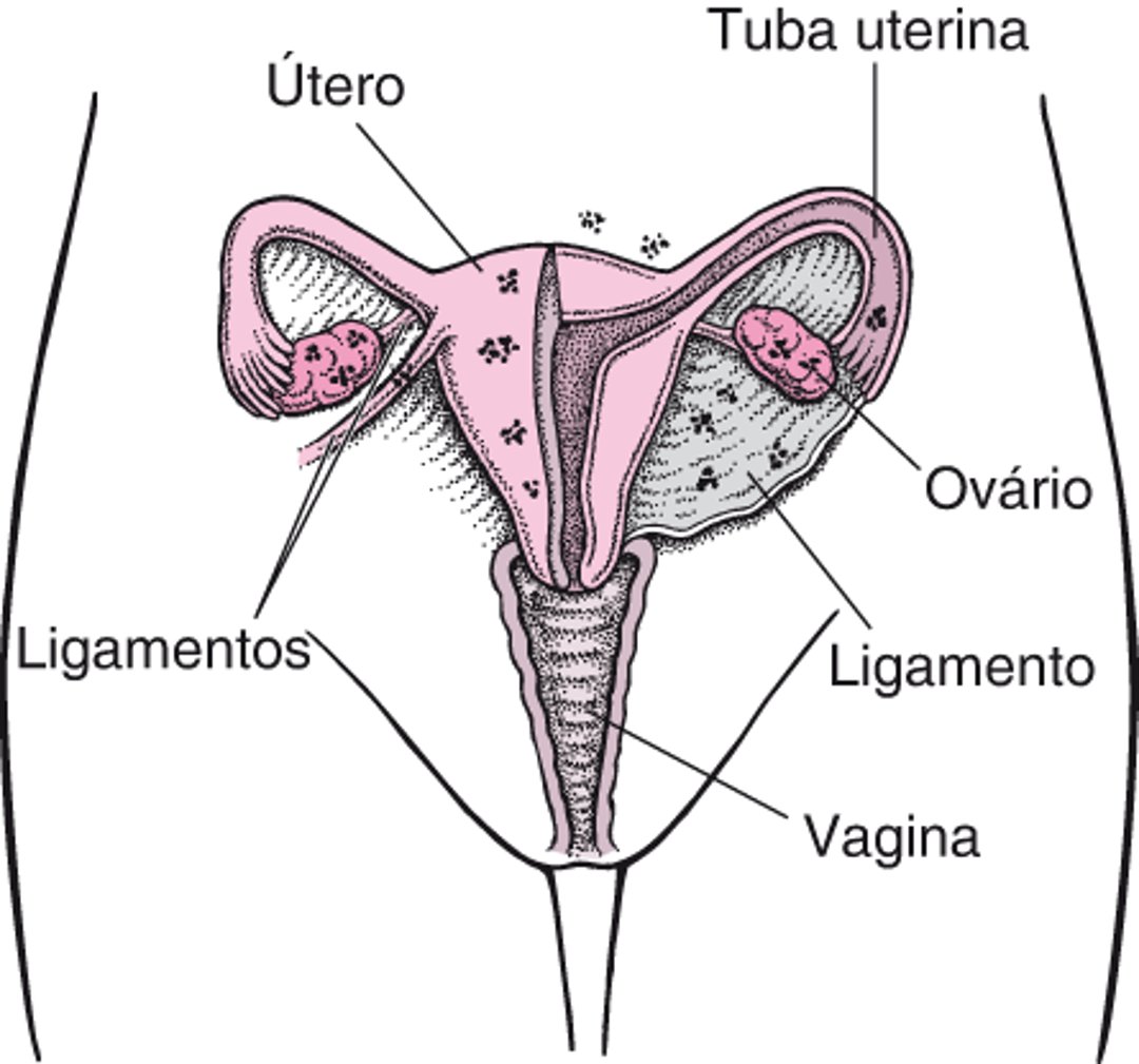 Endometriose: Tecido ectópico