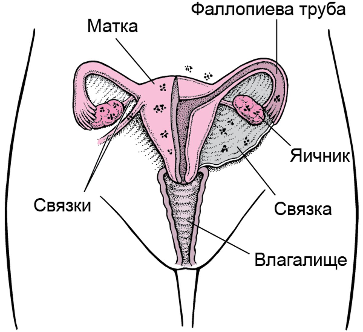 Эндометриоз: Аномально расположенная ткань