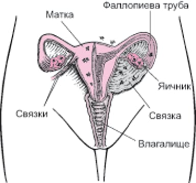 Эндометриоз: Аномально расположенная ткань