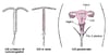 Informazioni sugli IUD