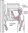 Mammography: Screening for Breast Cancer