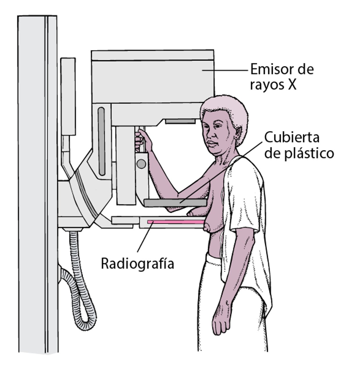 Mamografía: cribado del cáncer de mama