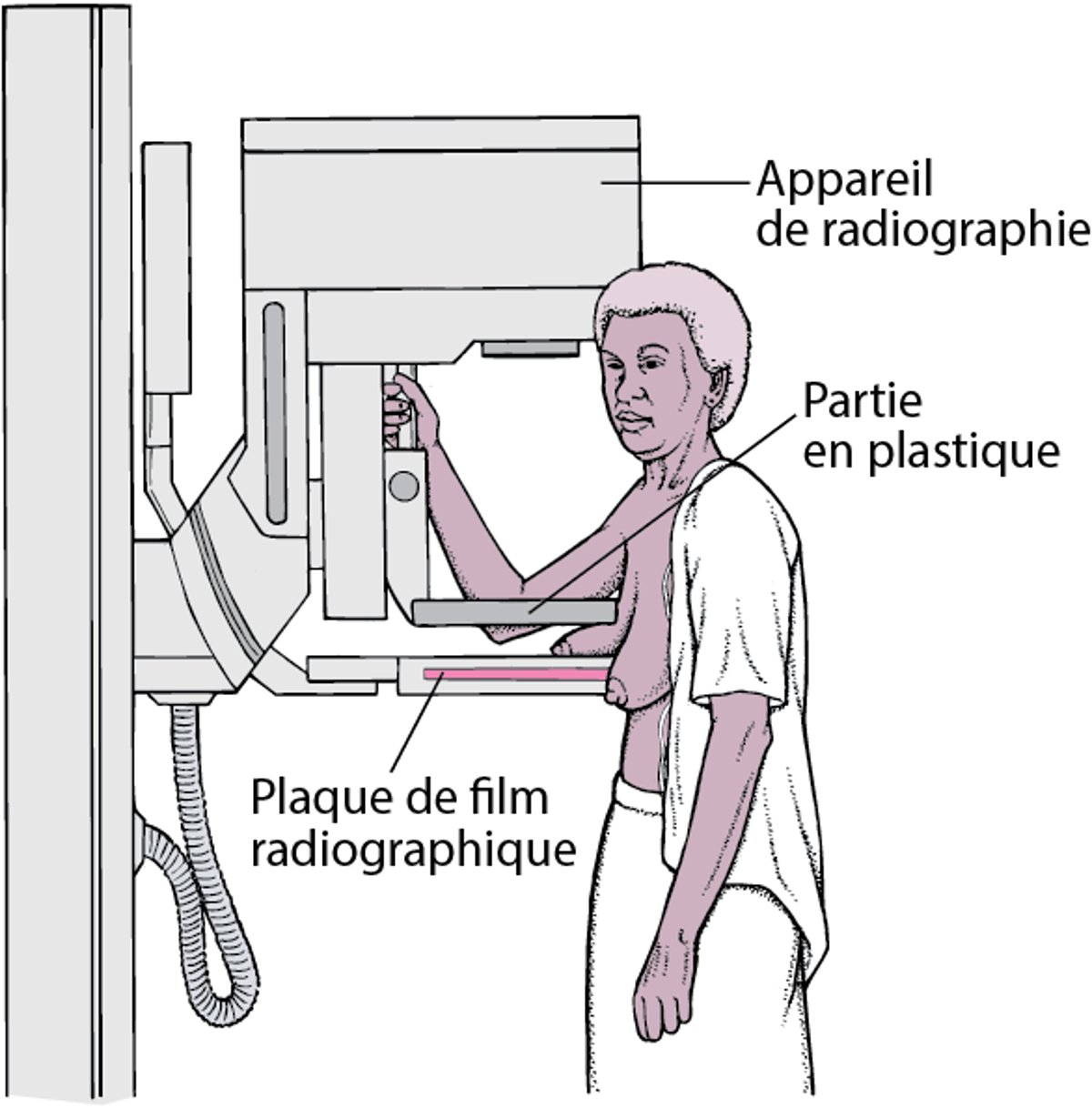 Mammographie : dépistage du cancer du sein