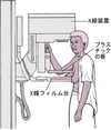 マンモグラフィー：乳がんのスクリーニング