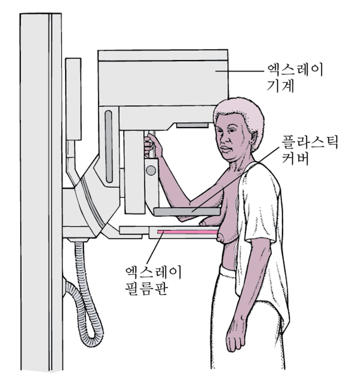 유방조영술: 유방암 선별검사