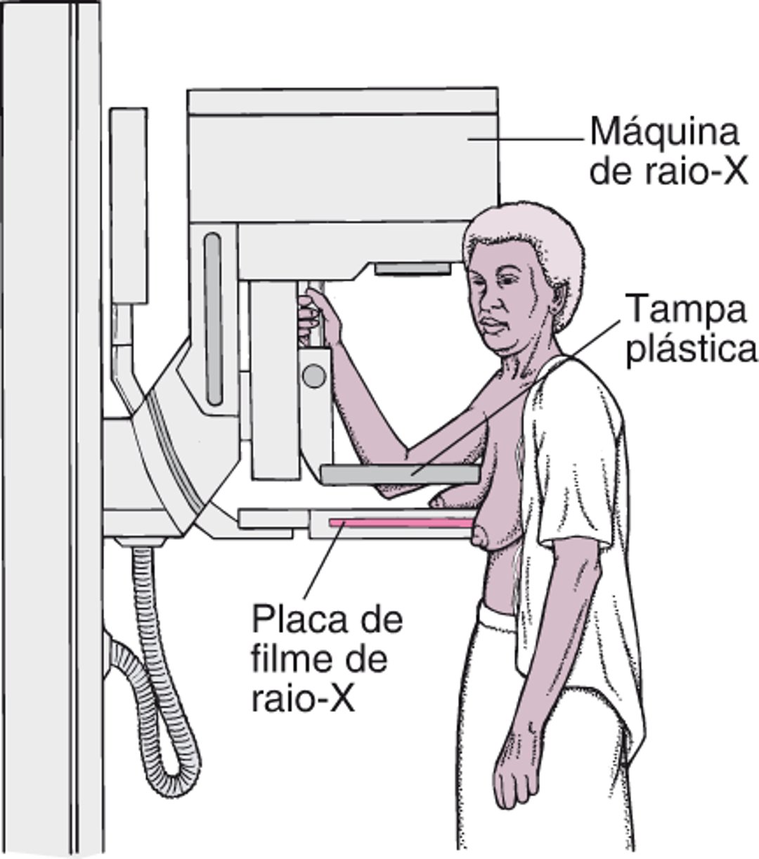 Mamografia: Exames preventivos para o câncer de mama