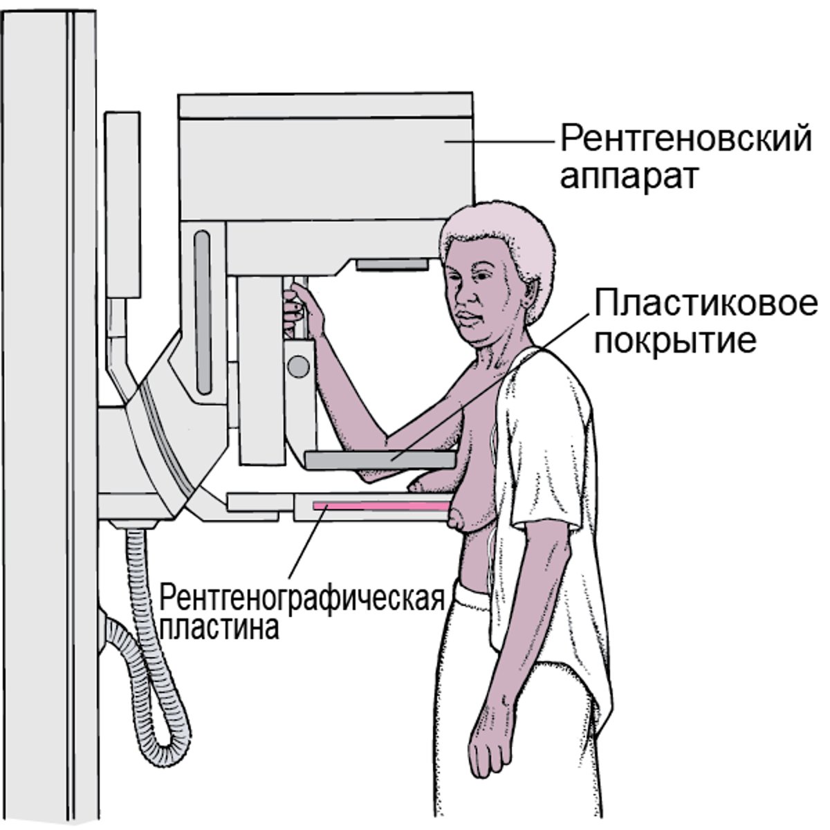 Маммография: Скрининг на рак молочной железы