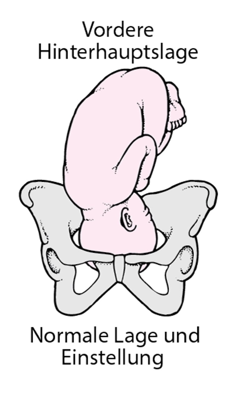 Normale Geburtslage und Haltung des Kindes