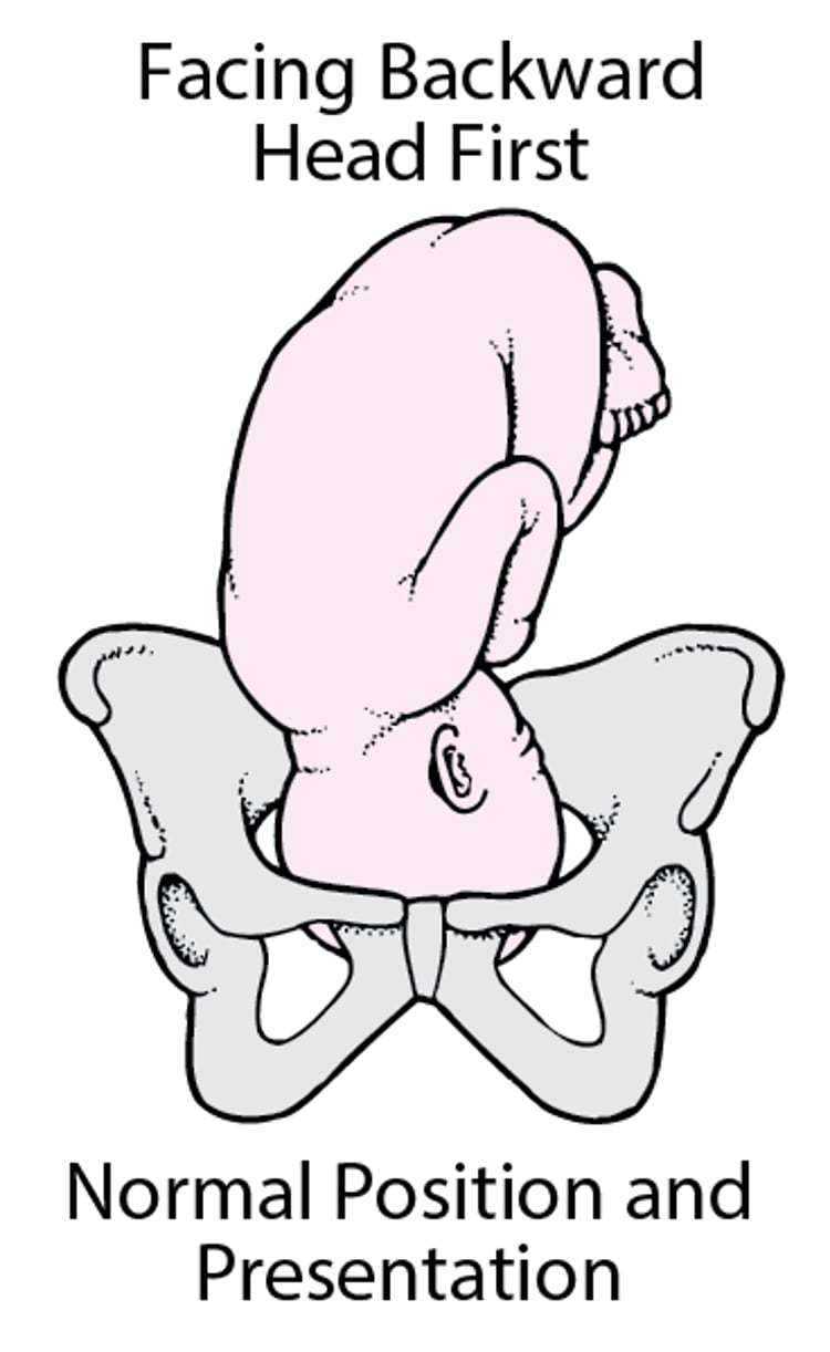 Posición y presentación normal del feto