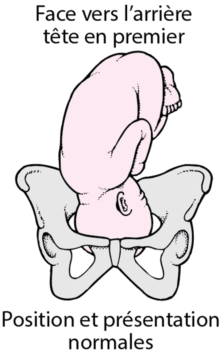 Position et présentation normales du fœtus