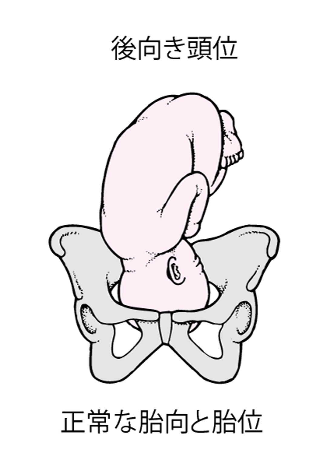 正常な胎向と胎位