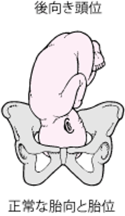正常な胎向と胎位